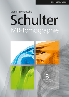 Schulter – MR-Tomographie – Expertencoach