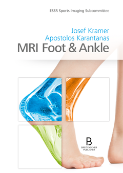 MRI Foot & Ankle