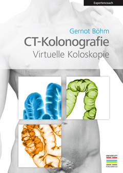 CT-Kolonografie, Virtuelle Koloskopie