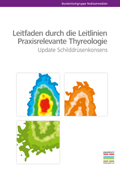 Leitfaden durch die Leitlinien – Praxisrelevante Thyreologie, Update Schilddrüsenkonsens